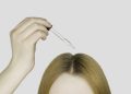 This $9 Product Finally Helped Me Manage My Scalp Psoriasis
